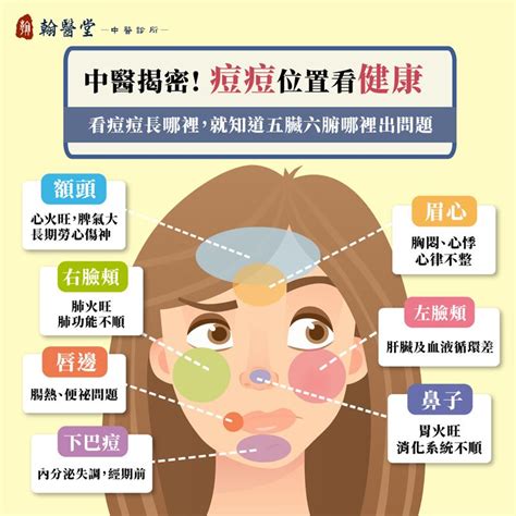 痘痘長得位置|青春痘、下巴痘痘長這個位置代表什麼意思？先弄懂長。